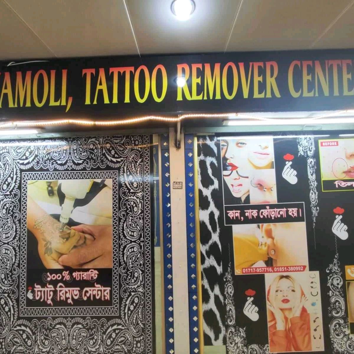 Shyamoli Tattoo Remover Center